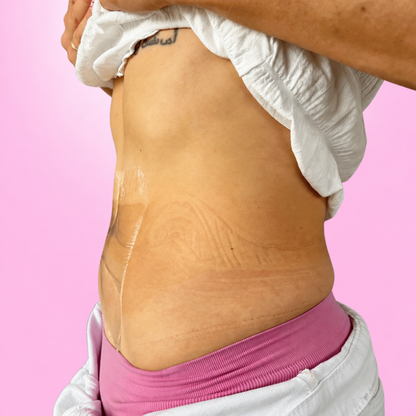 Realza · Cintas lifting para el abdomen (10 cintas)